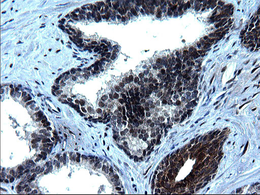 ZFAND3 Antibody in Immunohistochemistry (Paraffin) (IHC (P))