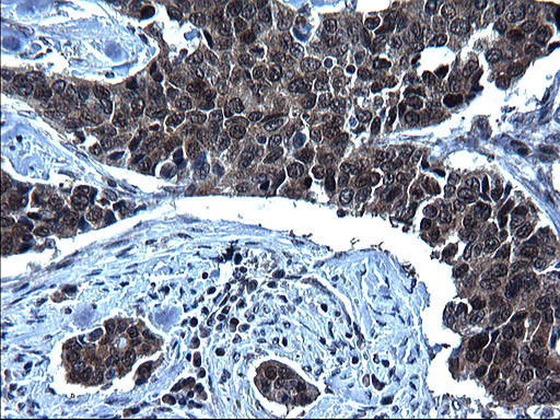 ZFAND3 Antibody in Immunohistochemistry (Paraffin) (IHC (P))