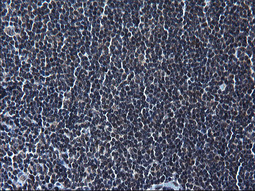 ZFAND3 Antibody in Immunohistochemistry (Paraffin) (IHC (P))