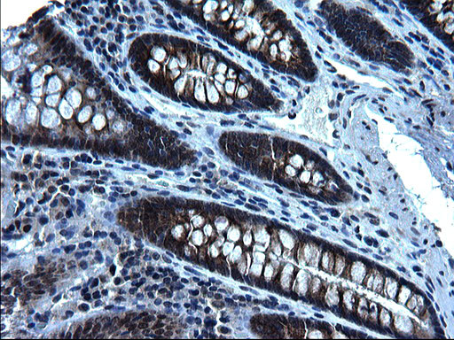 ZFAND3 Antibody in Immunohistochemistry (Paraffin) (IHC (P))