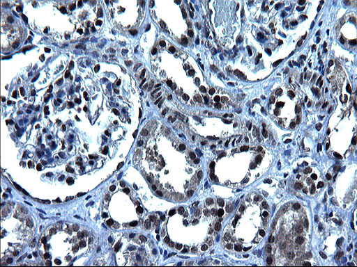 ZFAND3 Antibody in Immunohistochemistry (Paraffin) (IHC (P))