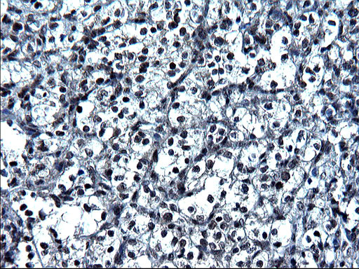 ZFAND3 Antibody in Immunohistochemistry (Paraffin) (IHC (P))