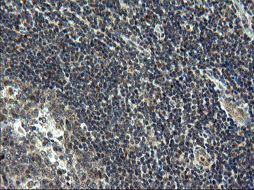 ZFAND3 Antibody in Immunohistochemistry (Paraffin) (IHC (P))