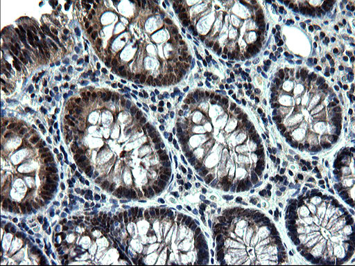 ZFAND3 Antibody in Immunohistochemistry (Paraffin) (IHC (P))