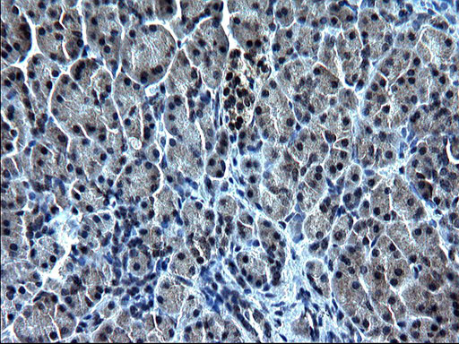 ZFAND3 Antibody in Immunohistochemistry (Paraffin) (IHC (P))