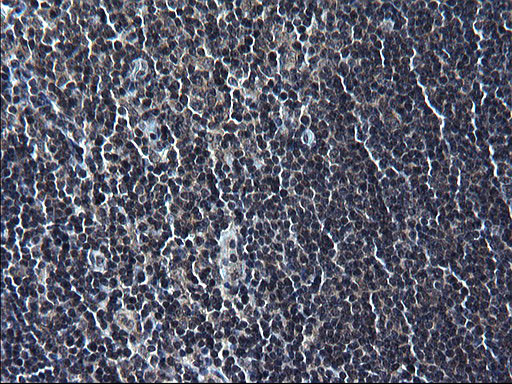 ZFAND3 Antibody in Immunohistochemistry (Paraffin) (IHC (P))