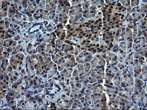 ZFAND3 Antibody in Immunohistochemistry (Paraffin) (IHC (P))