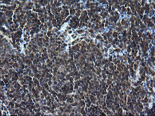 ZFAND3 Antibody in Immunohistochemistry (Paraffin) (IHC (P))