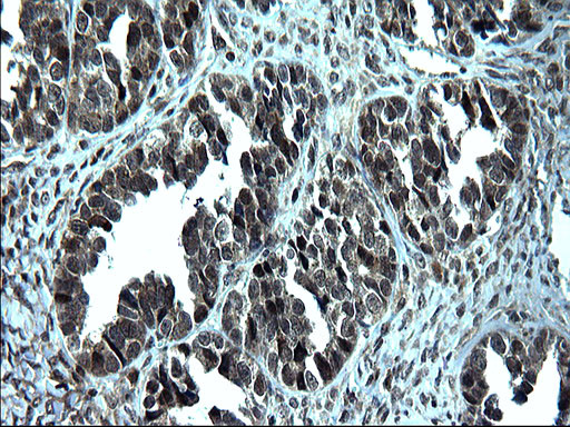 ZFAND3 Antibody in Immunohistochemistry (Paraffin) (IHC (P))