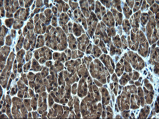 ZFAND3 Antibody in Immunohistochemistry (Paraffin) (IHC (P))