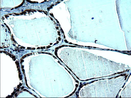 ZFAND3 Antibody in Immunohistochemistry (Paraffin) (IHC (P))