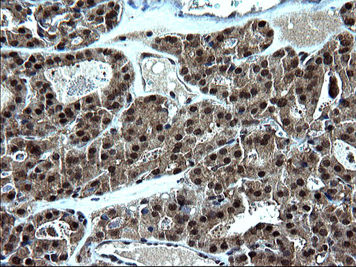 ZFAND3 Antibody in Immunohistochemistry (Paraffin) (IHC (P))