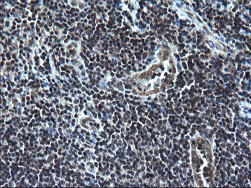 ZFAND3 Antibody in Immunohistochemistry (Paraffin) (IHC (P))