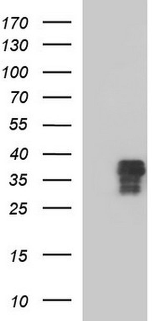 ZFAND3 Antibody in Western Blot (WB)