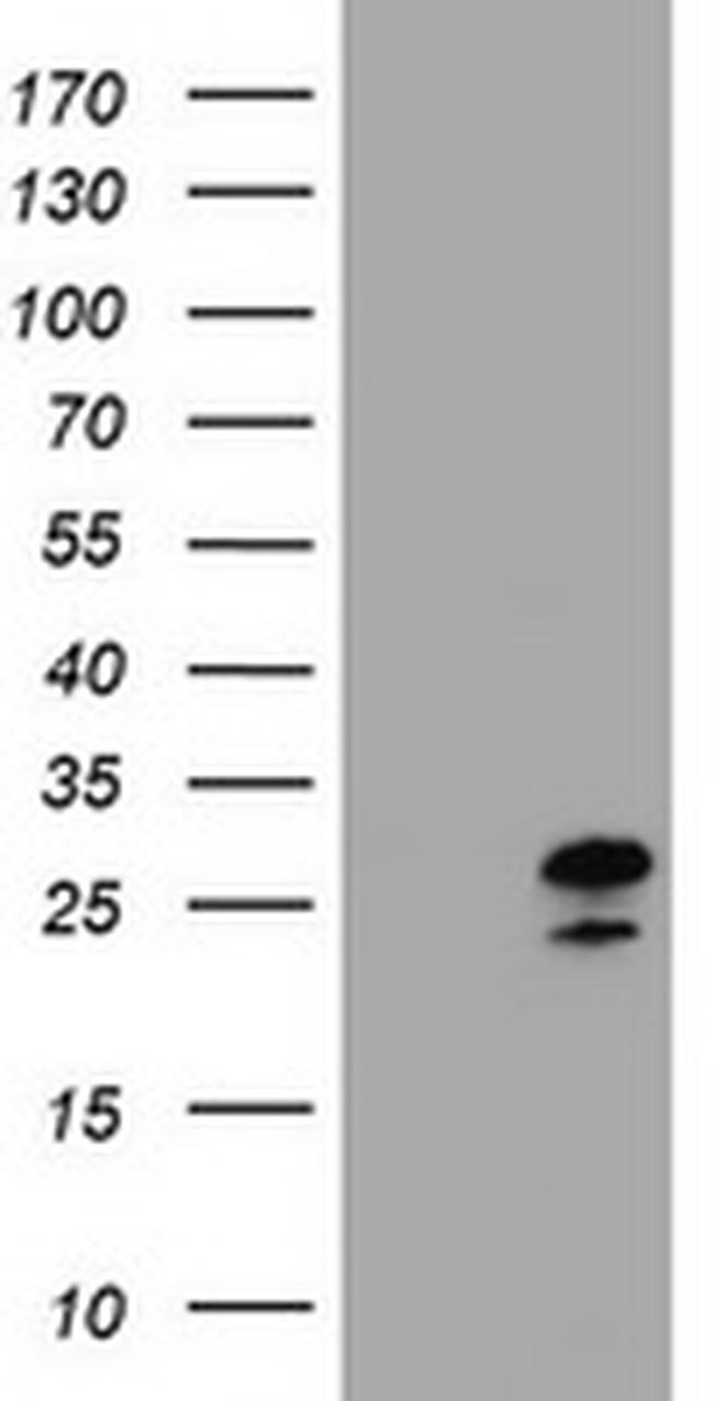 ZFAND5 Antibody in Western Blot (WB)