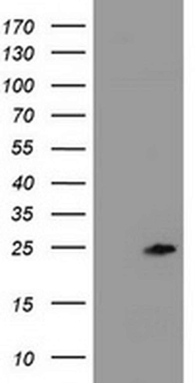 ZFAND5 Antibody in Western Blot (WB)