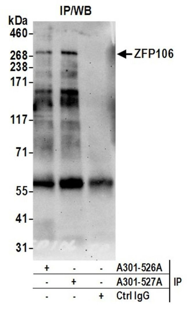 ZFP106 Antibody in Immunoprecipitation (IP)