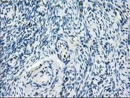 ZFP36 Antibody in Immunohistochemistry (Paraffin) (IHC (P))