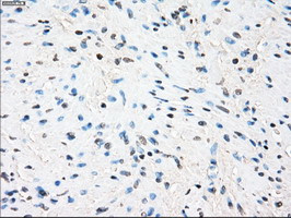 ZFP36 Antibody in Immunohistochemistry (Paraffin) (IHC (P))