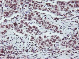 ZFP36 Antibody in Immunohistochemistry (Paraffin) (IHC (P))