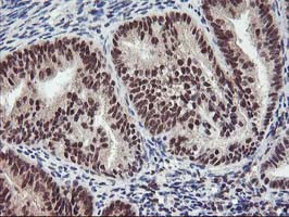 ZFP36 Antibody in Immunohistochemistry (Paraffin) (IHC (P))