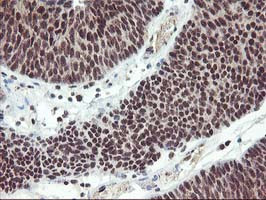 ZFP36 Antibody in Immunohistochemistry (Paraffin) (IHC (P))