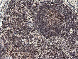 ZFP36 Antibody in Immunohistochemistry (Paraffin) (IHC (P))