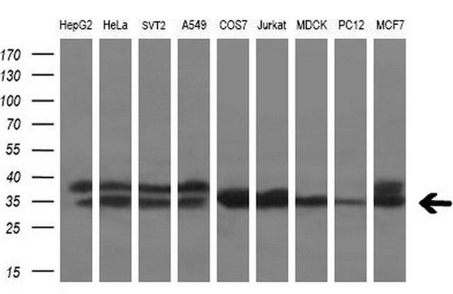 ZFP36 Antibody in Western Blot (WB)