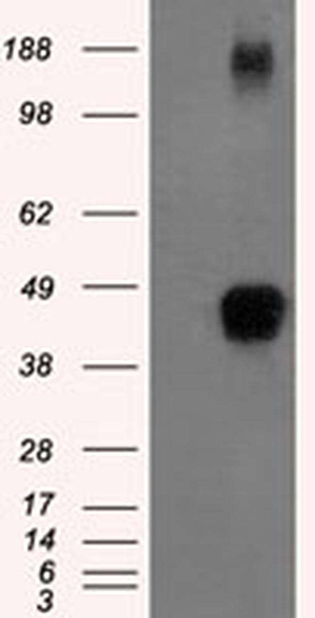 ZFP36 Antibody in Western Blot (WB)