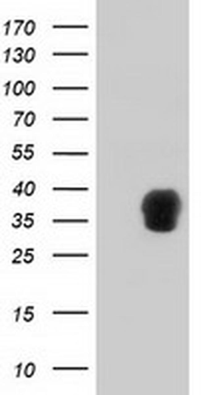 ZFP36 Antibody in Western Blot (WB)