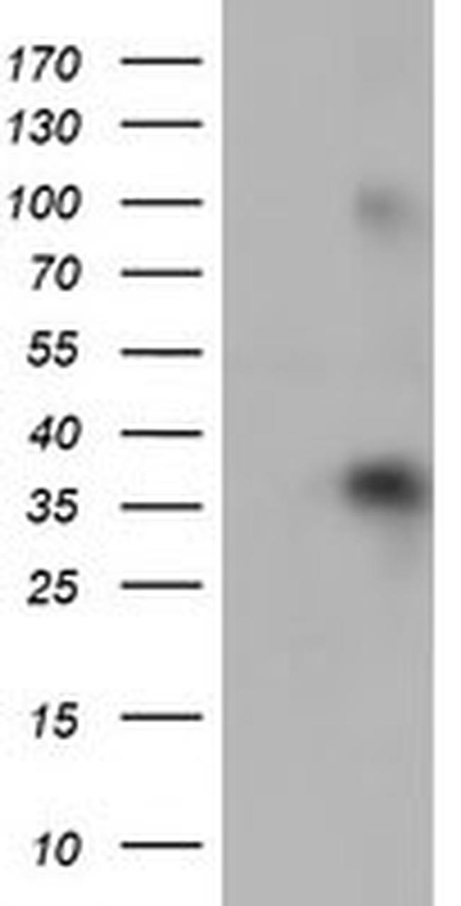 ZFP36 Antibody in Western Blot (WB)