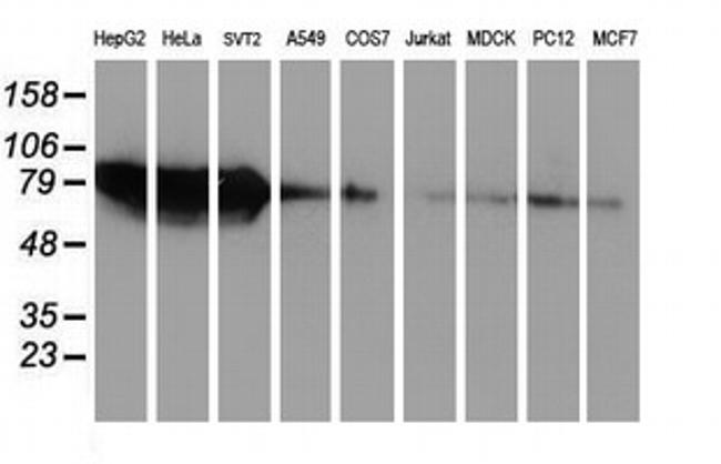 ZFP36 Antibody in Western Blot (WB)