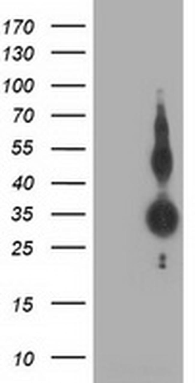 ZFP36 Antibody in Western Blot (WB)