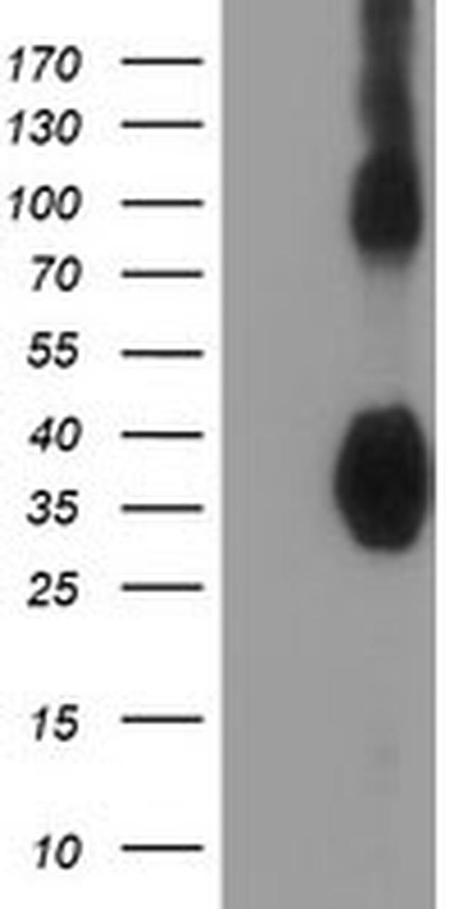 ZFP36 Antibody in Western Blot (WB)