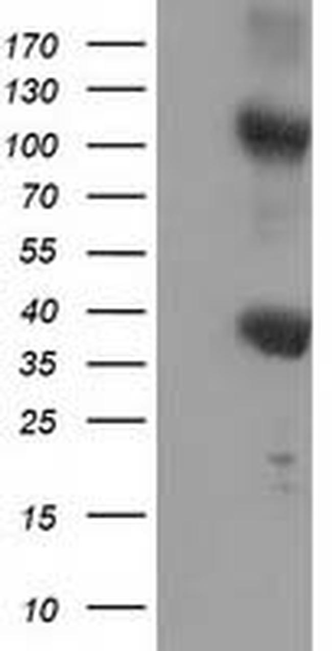 ZFP36 Antibody in Western Blot (WB)