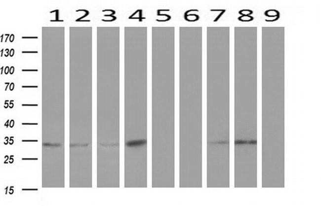 ZFP36 Antibody in Western Blot (WB)