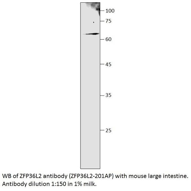 ZFP36L2 Antibody in Western Blot (WB)