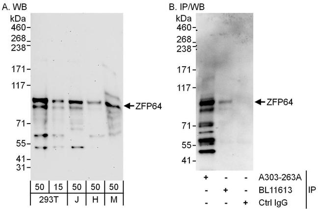 ZFP64 Antibody in Western Blot (WB)