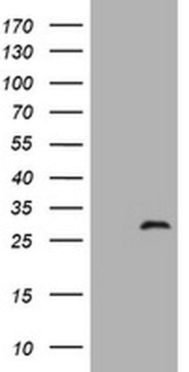 ZFYVE21 Antibody in Western Blot (WB)