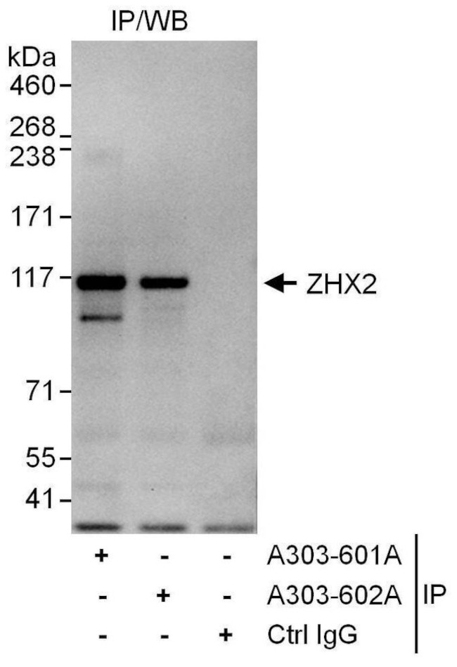 ZHX2 Antibody in Immunoprecipitation (IP)