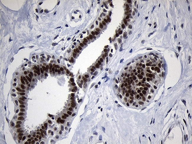 ZHX2 Antibody in Immunohistochemistry (Paraffin) (IHC (P))