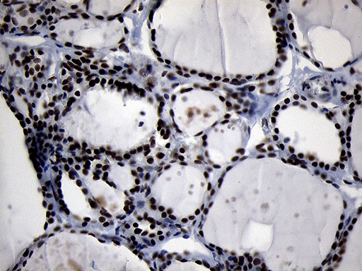 ZHX2 Antibody in Immunohistochemistry (Paraffin) (IHC (P))