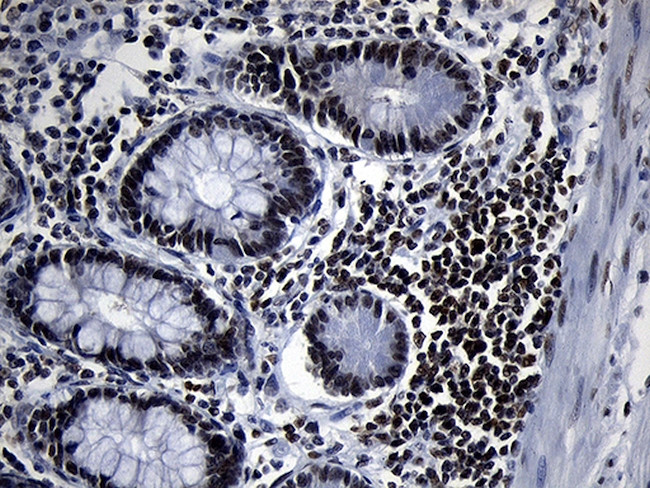 ZHX2 Antibody in Immunohistochemistry (Paraffin) (IHC (P))