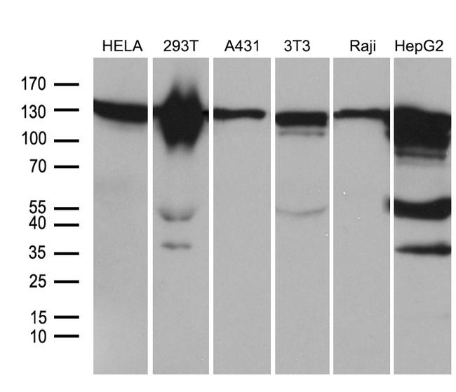 ZHX2 Antibody in Western Blot (WB)