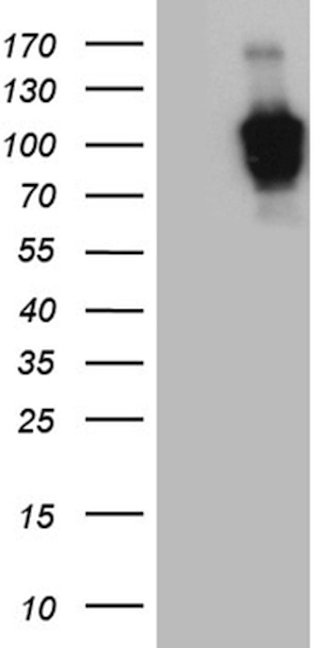 ZHX2 Antibody in Western Blot (WB)