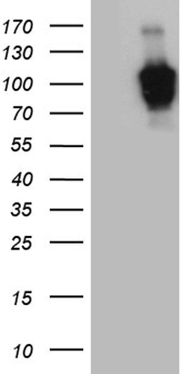 ZHX2 Antibody in Western Blot (WB)