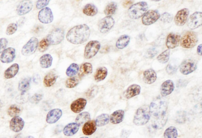 ZHX3 Antibody in Immunohistochemistry (IHC)