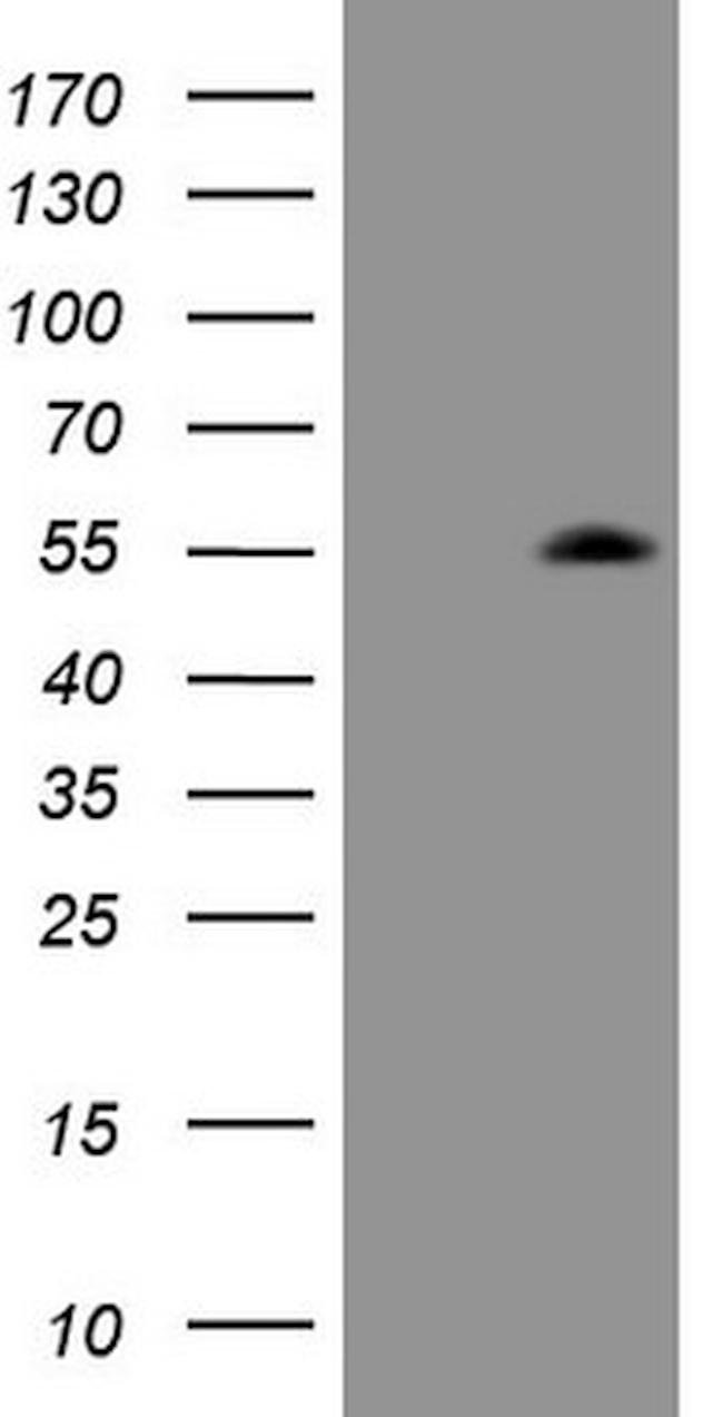 ZIC3 Antibody in Western Blot (WB)