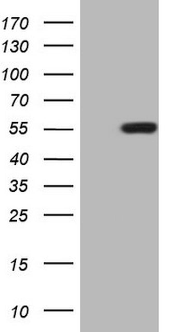 ZIC3 Antibody in Western Blot (WB)