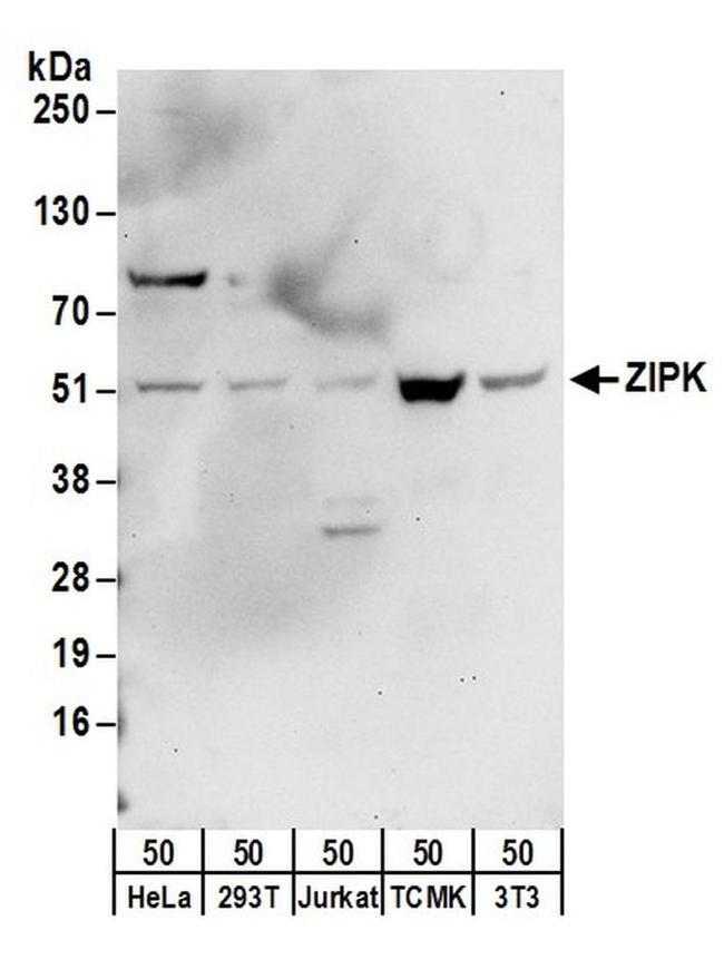 ZIPK Antibody in Western Blot (WB)